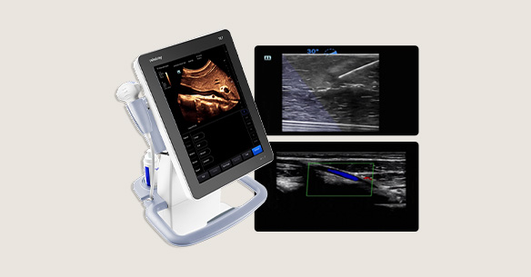 각질 수분, 피지 분비, pH(피부산도) 측정기